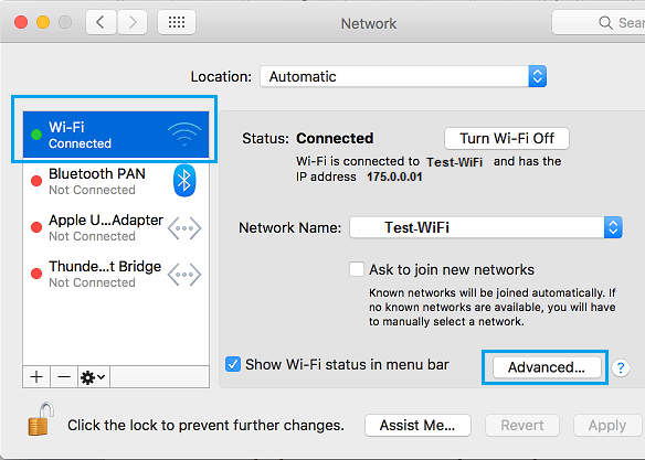 Opción avanzada en la pantalla de configuración de red en Mac